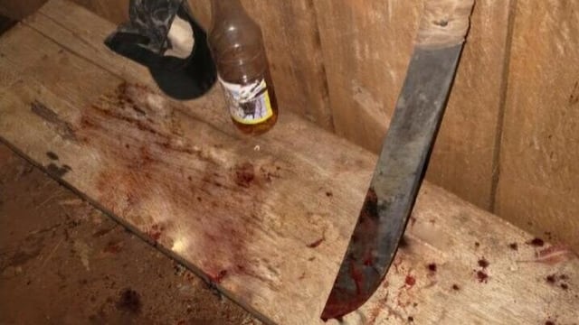 El ataque podría darse por el excesivo consumo de alcohol.
