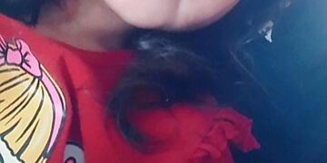 Emma tiene 2 años y le descubrieron un tumor no operable alojado en el cerebelo.