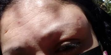 Una mujer fue desfigurada tras intentar evitar un robo.