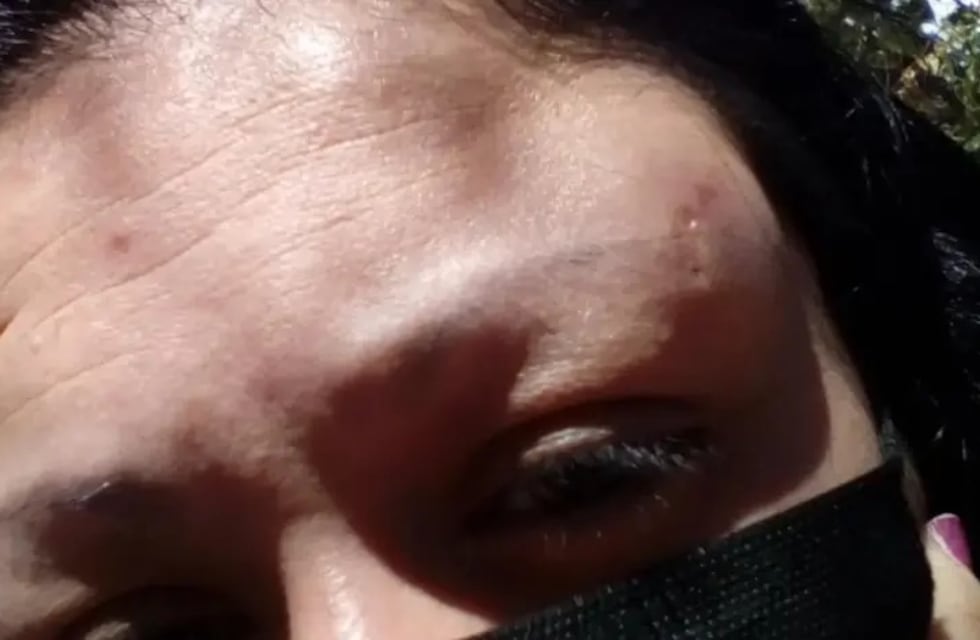 Inseguridad en Alta Gracia: desfiguraron a una comerciante tras resistirse a un asalto