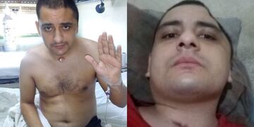 Leandro López, el joven mendocino que fue atropellado y se salvó de milagro.