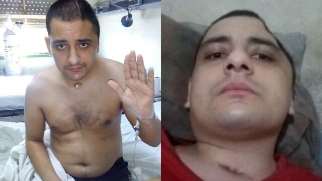 Leandro López, el joven mendocino que fue atropellado y se salvó de milagro.