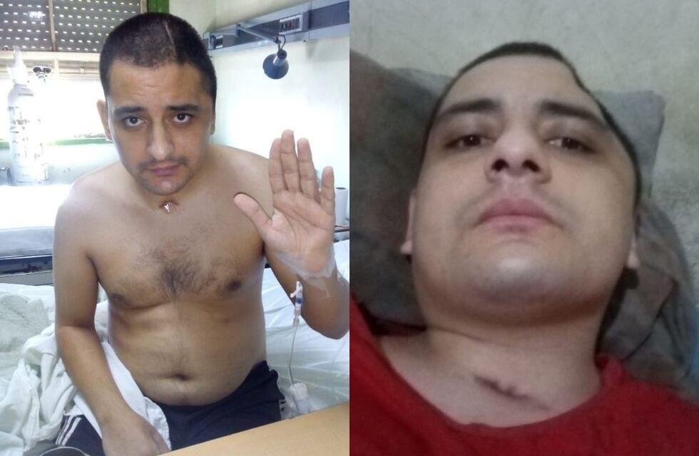 Fue atropellado, perdió parte de su cráneo y ofrece una importante recompensa para dar con el responsable