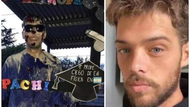 "Todos por Pachi". Necesita juntar 35 mil dólares para un tratamiento y recuperar la visión.