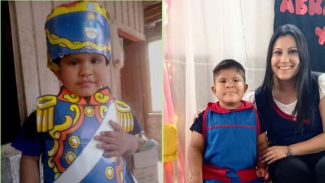 Matías Ríos, el salteño de 5 años que necesita dos implantes.