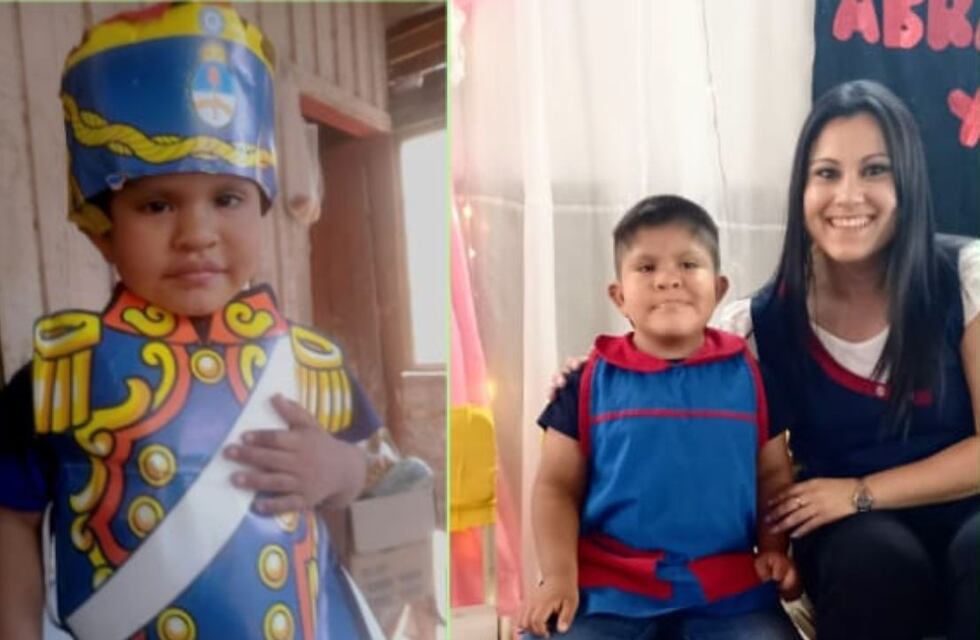 Salta: un niño de 5 años necesita dos implantes que valen 56.000 dólares