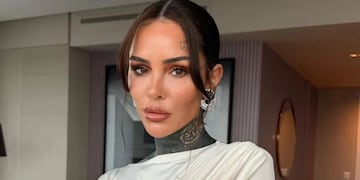 Preocupación por la salud de Cande Tinelli: tuvo un accidente y fue operada de urgencia