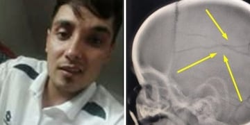 Maximiliano Roth, golpeador de niños detenido en Coronel Suárez