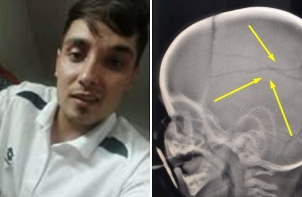 Un golpeador de niños fue liberado por un juez: volvió a atacar y le fracturó el cráneo a un bebé