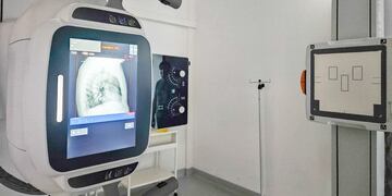 El Hospital Modular de Tolhuin sumó un nuevo equipo de rayos X