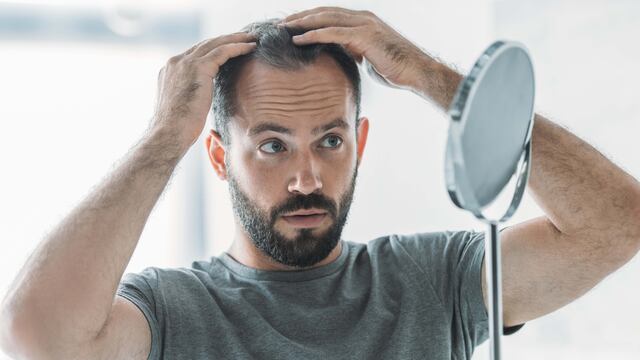 La caída del pelo tiene diversas causas y hay tratamientos. (Foto:123)