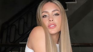 El antes y después de Milett Figueroa, la nueva novia de Marcelo Tinelli.