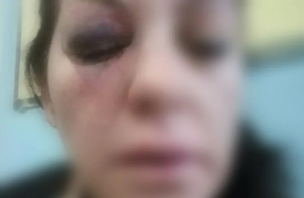 Natalia denunció que su ex pareja quiso matarla en Villa Mercedes