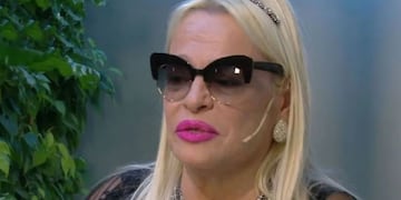 El grave accidente doméstico que sufrió Silvia Süller y preocupó a sus seguidores