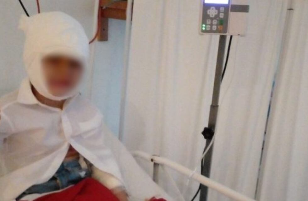 Madre denunció que su hijo fue electrocutado durante un estudio en el hospital Samic de Eldorado