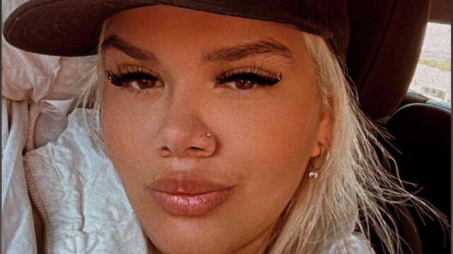 Morena Rial pasó por el quirófano nuevamente y mostró los resultados en Instagram