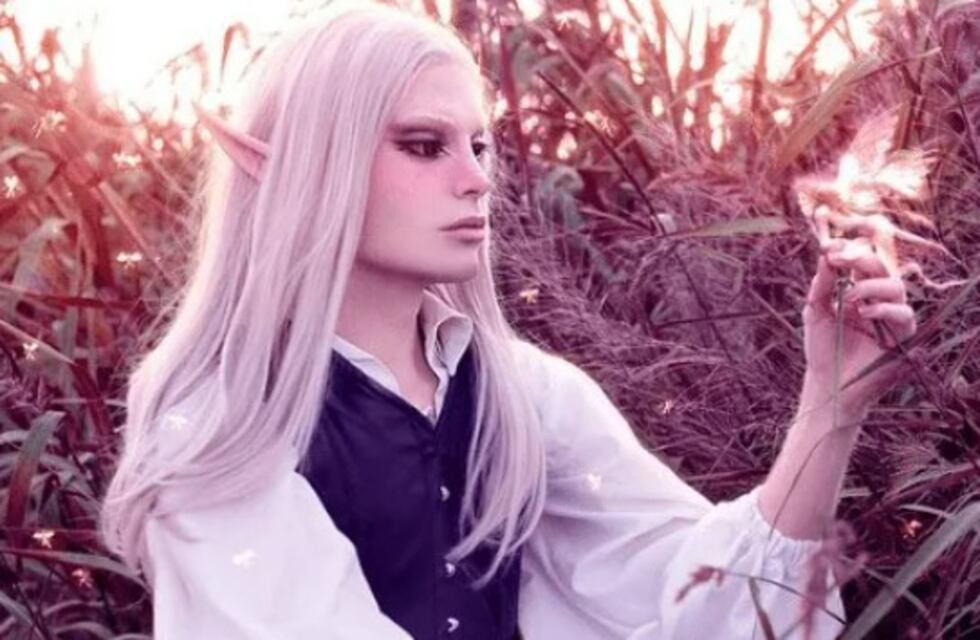 Un formoseño gastó más de 85.000 dólares en cirugías estéticas para parecerse a un elfo