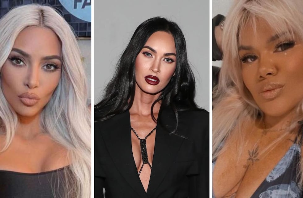 Qué es la bichectomía, el retoque estético de Kim Kardashian, Megan Fox y More Rial para lucir un rostro más delgado