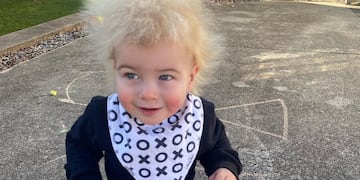 Locklan Samples padece de SCI.