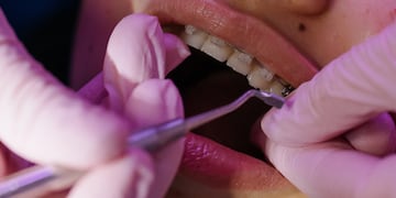 Los turnos se otorgan de forma presencial todas las mañanas de días hábiles.