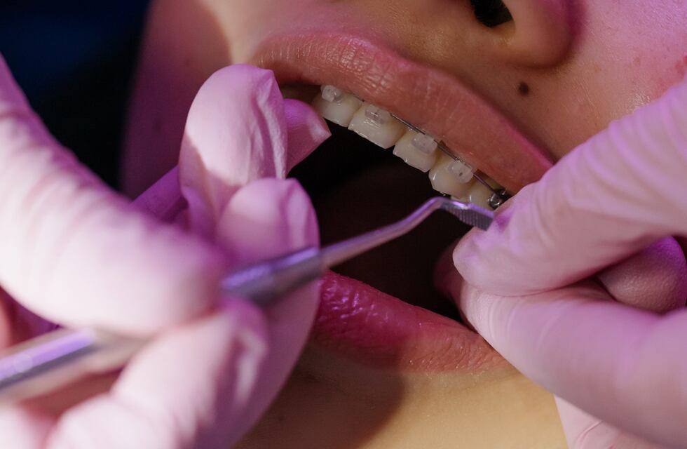 El móvil odontológico atiende pacientes hasta fin de mes en CoFrutHoS