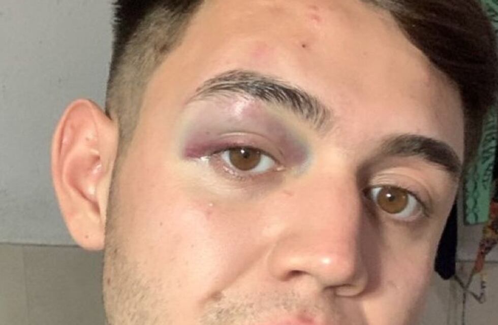 Un joven acusó ser golpeado por la guardia de un boliche en Carlos Paz