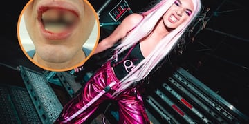 La Queen de Fuerte Apache, brutalmente agredida