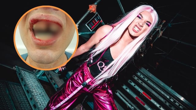 La Queen de Fuerte Apache, brutalmente agredida