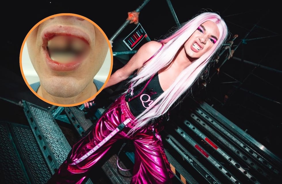 Brutal agresión a La Queen de Fuerte Apache: le rompieron un diente mientras le gritaban “morite por p...”