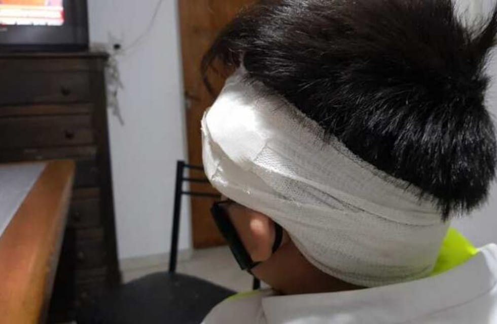 Córdoba: atropelló a un niño con la moto y se fugó