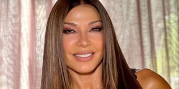 Preocupación por la salud de Catherine Fulop: deberá someterse a una operación tras su caída del escenario de Erreway