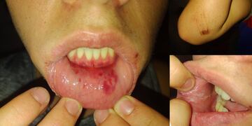 Un adolescente contó que fue brutalmente golpeado por los guardias de un boliche de la ciudad.