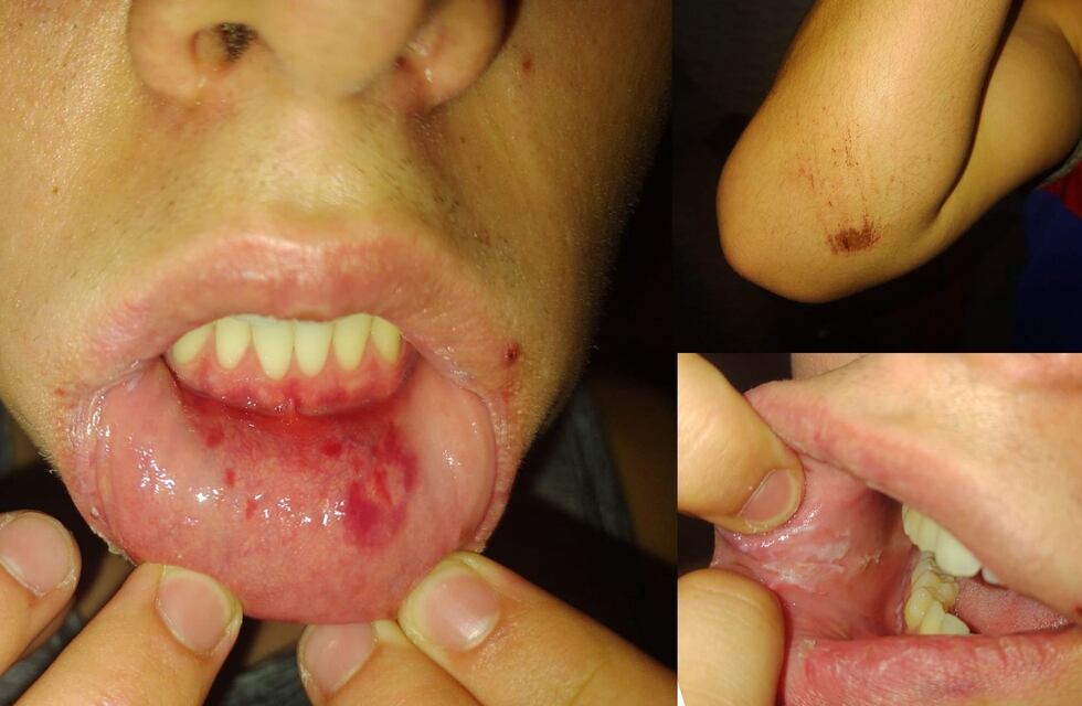 Córdoba: tiene 17 años, salió a bailar y denuncia que guardias de un conocido boliche, lo golpearon