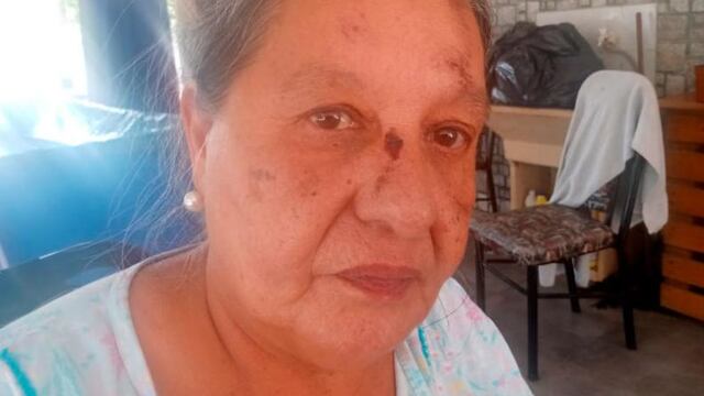 Patricia cayó del colectivo 52 y acusa al chofer por una maniobra brusca que pudo costarle la vida.