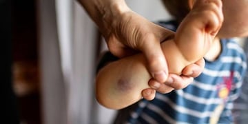 Una bebé de un año y 8 meses recibió maltrato infantil. Foto ilustrativa
