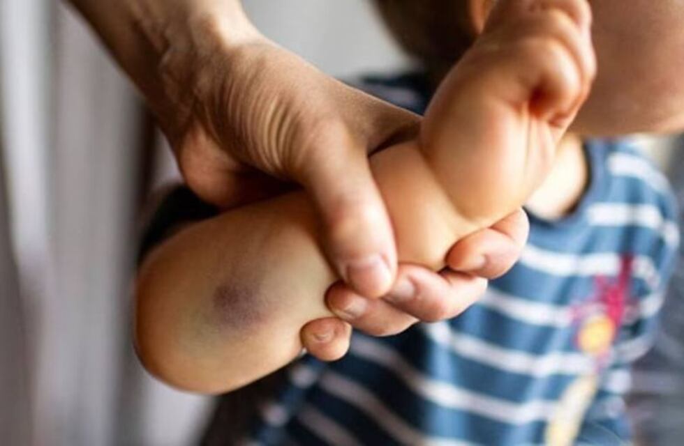 Una pareja de San Juan golpeó a su bebé “por inquieta” y fueron condenados