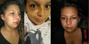 El violento golpeó brutalmente a la joven en reiteradas ocasiones frente a sus hijos.