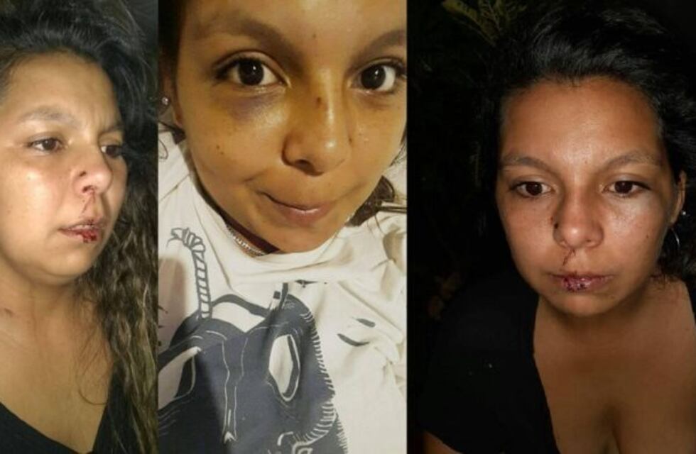 Violencia de género: una joven publicó un desesperado pedido de ayuda en las redes