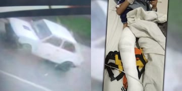 Un conductor atropelló a un niño en La Plata y se dio a la fuga.