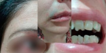 Viralizó el caso de violencia de género hacia su mamá y logró la detención del agresor