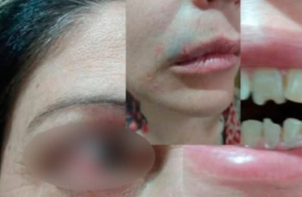 Bahía Blanca: viralizó la violencia que sufría su mamá y logró la detención del agresor