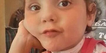Tiene 3 años y perdió a su mamá en el parto. Necesita operarse.