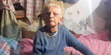 Dora. La jubilada resultó desfigurada en medio de un robo domiciliario. (Gentileza El Doce)