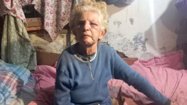 Dora. La jubilada resultó desfigurada en medio de un robo domiciliario. (Gentileza El Doce)