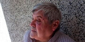 Así quedó el rostro del periodista.