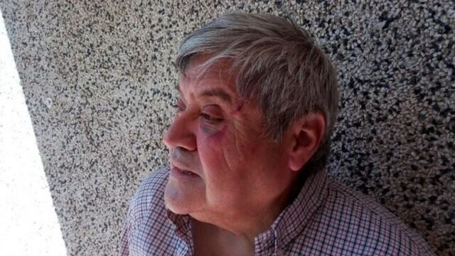 Así quedó el rostro del periodista.