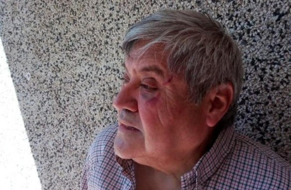 Asaltan y golpean al periodista Juan Rodríguez Brizuela