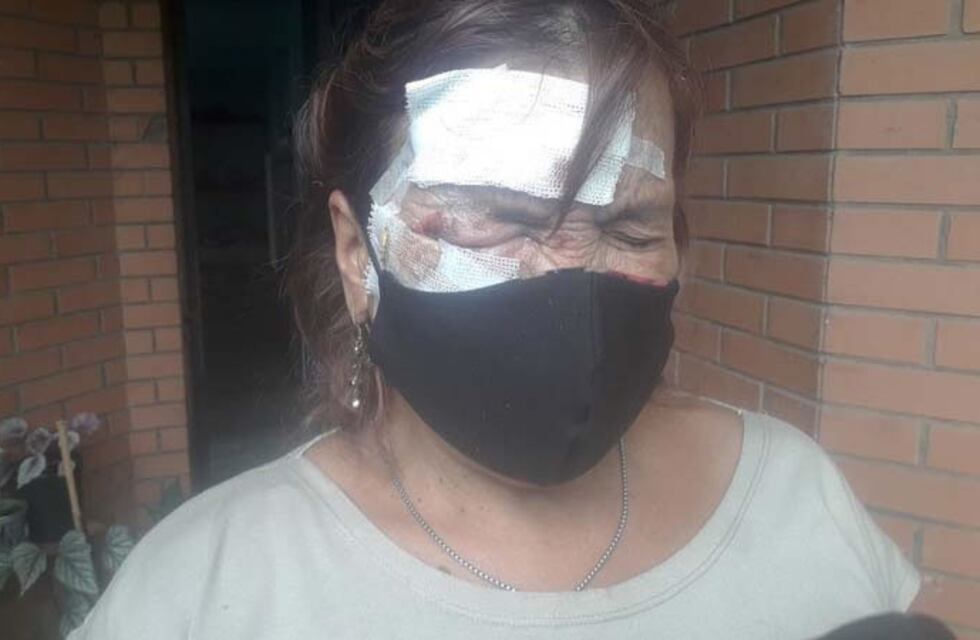 Desfiguraron la cara de una mujer para robarle la cartera