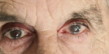 Ciego (imagen ilustrativa).