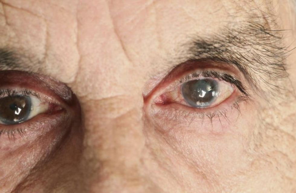 Por mala praxis lo dejaron ciego y ahora deben indemnizarlo